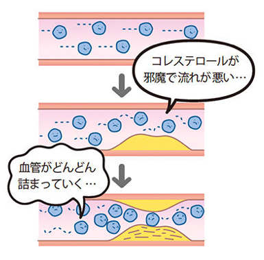 出典：https://www.mens-ex.jp/