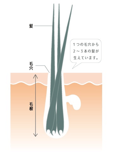 出典：http://kaminonayami119.com/