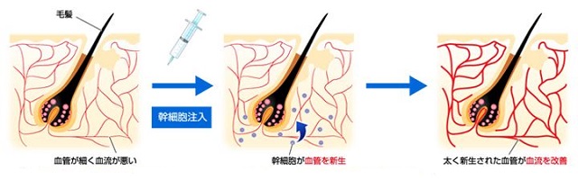 出典：https://www.mouhatsu-saisei.com/