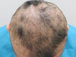 出典：http://www.hairmedical.com/