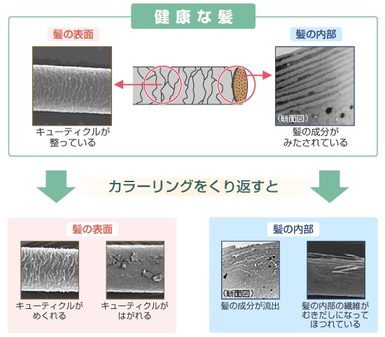 出典：http://www.hanabusa-medical.com/