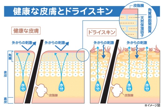 出典：http://www.yoshida-cl.com/