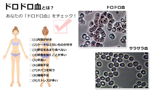 出典：https://plaza.rakuten.co.jp/kobutyan77/