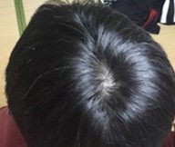 出典：http://hairs-media.com/