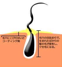 出典：http://alowa.co.jp/