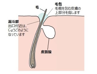 出典：https://eijingukea.nahls.co.jp/