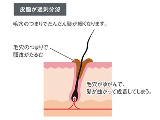 出典：http://rossa.jp/