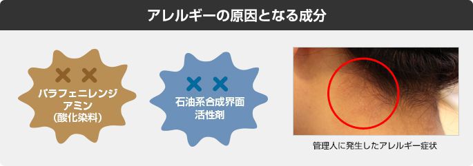 要注意!白髪染めによるアレルギー症状